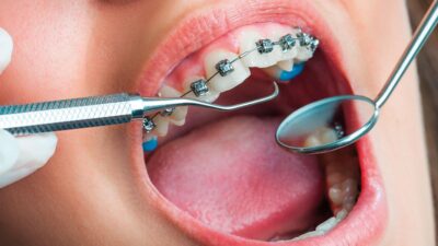 necessary to receive orthodontic treatment