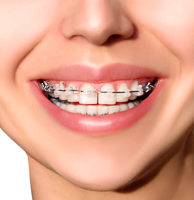 Cosmetic dental in NE Calgary